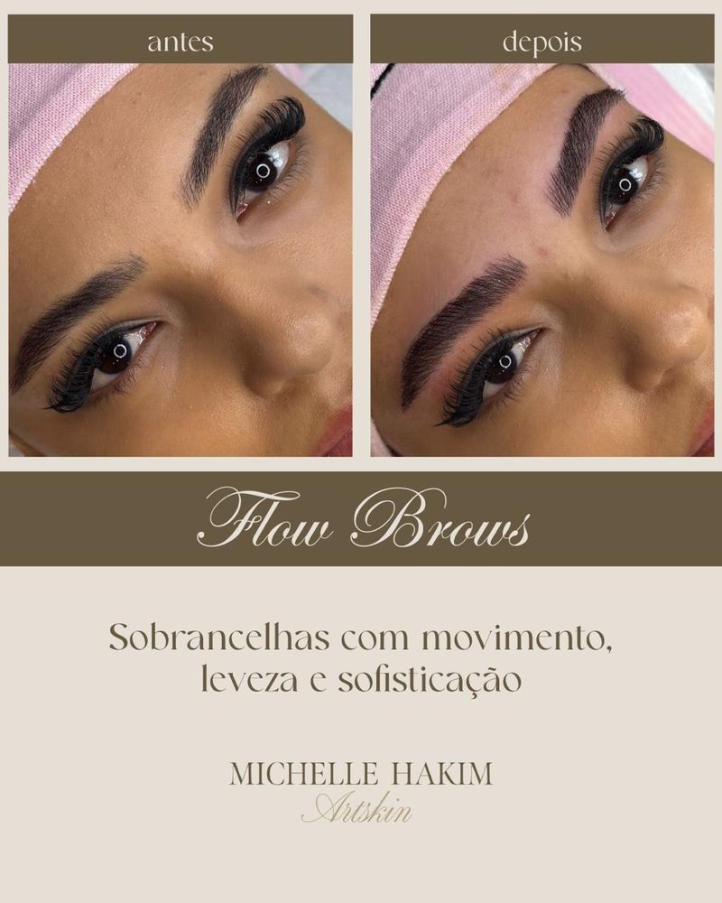 Antes e depois de Flow Browns Technique