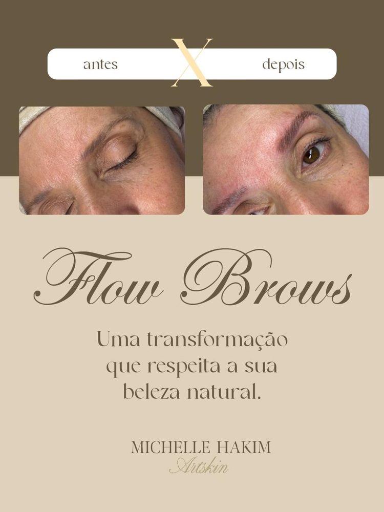 Antes e depois de Flow Browns Technique