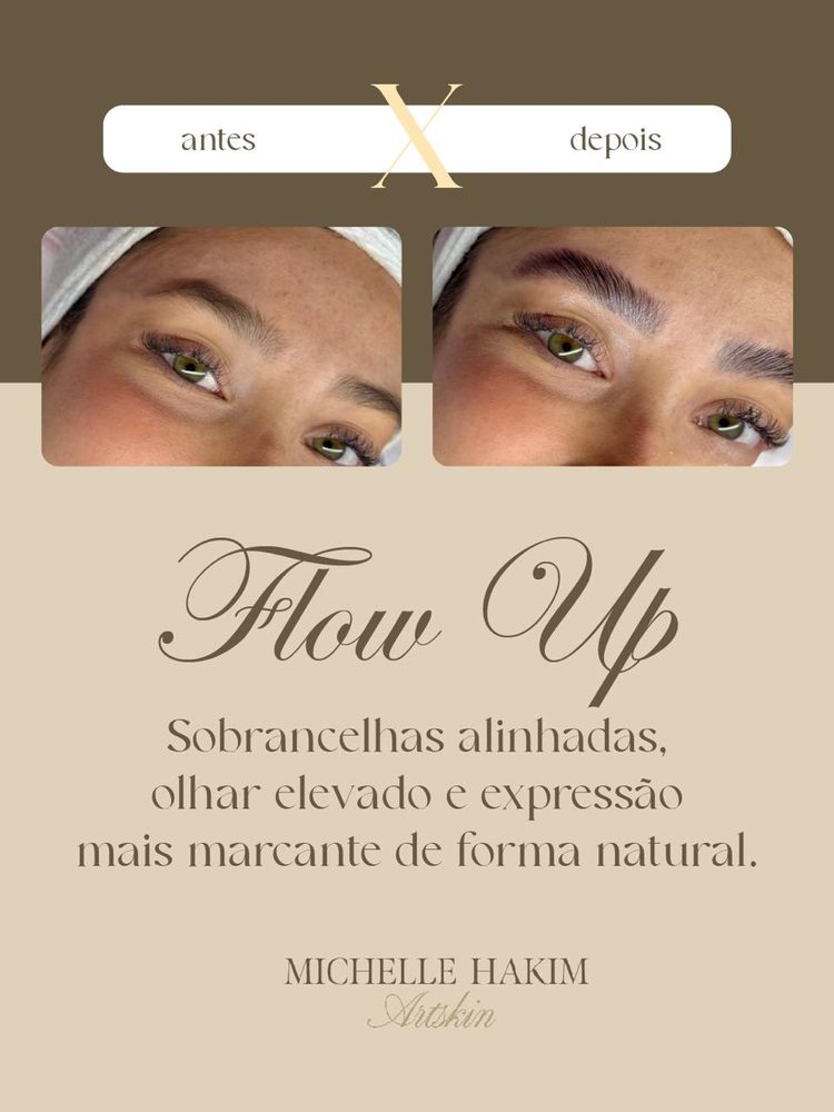 Antes e depois de Flow Up