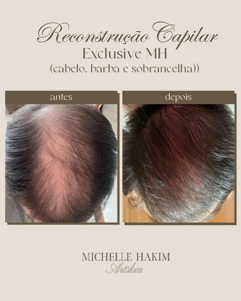 Antes e depois de Reconstrução Capilar Exclusive MH