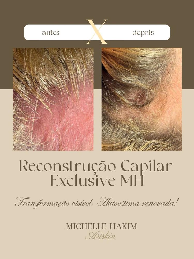 Antes e depois de Reconstrução Capilar Exclusive MH